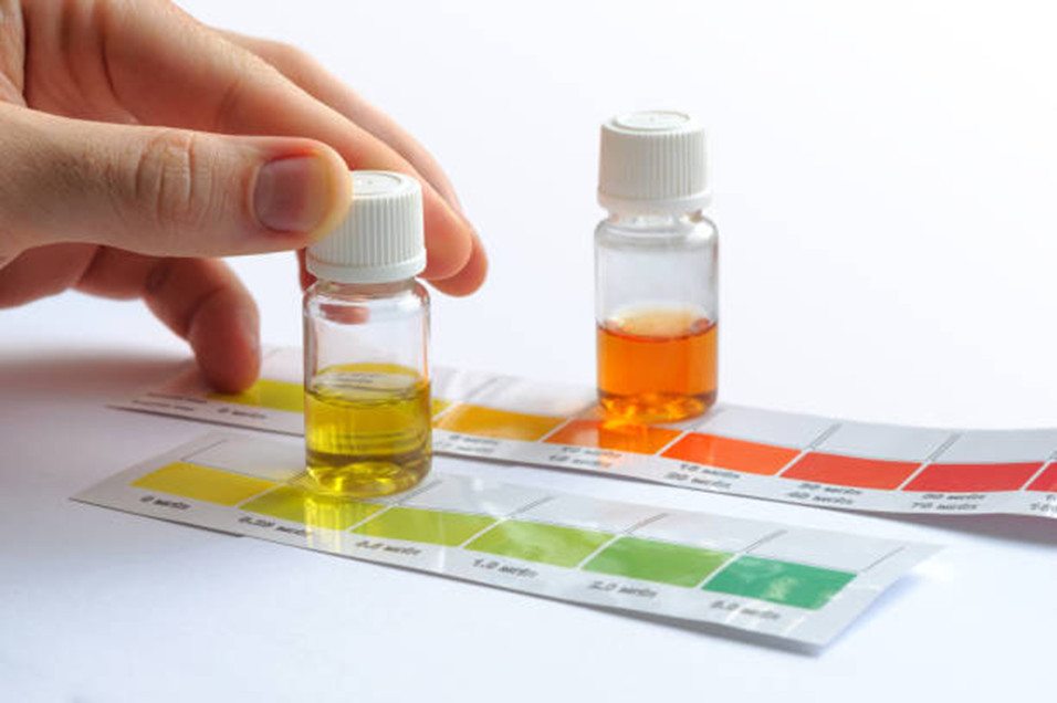 Test kit being used to ensure an aquarium parameters are suitable.